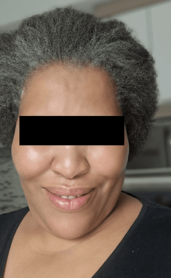 After - December 2025 - February 2026