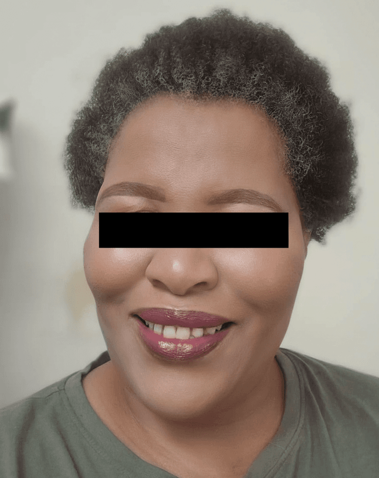 Before - December 2025 - February 2026